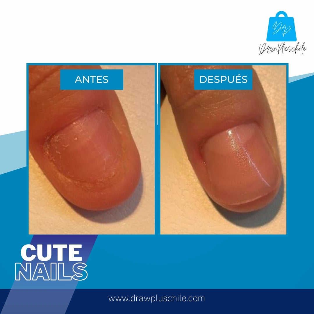 Revitalizador de uñas - CuteNails™