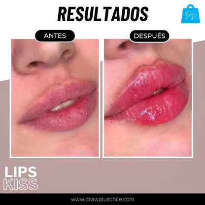 Voluminizador de labios - LipsKiss™