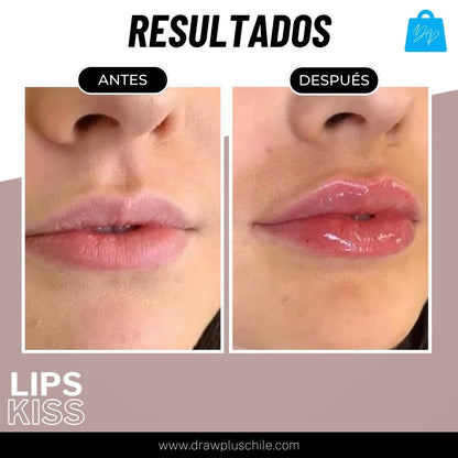 Voluminizador de labios - LipsKiss™