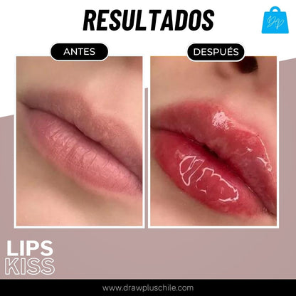 Voluminizador de labios - LipsKiss™