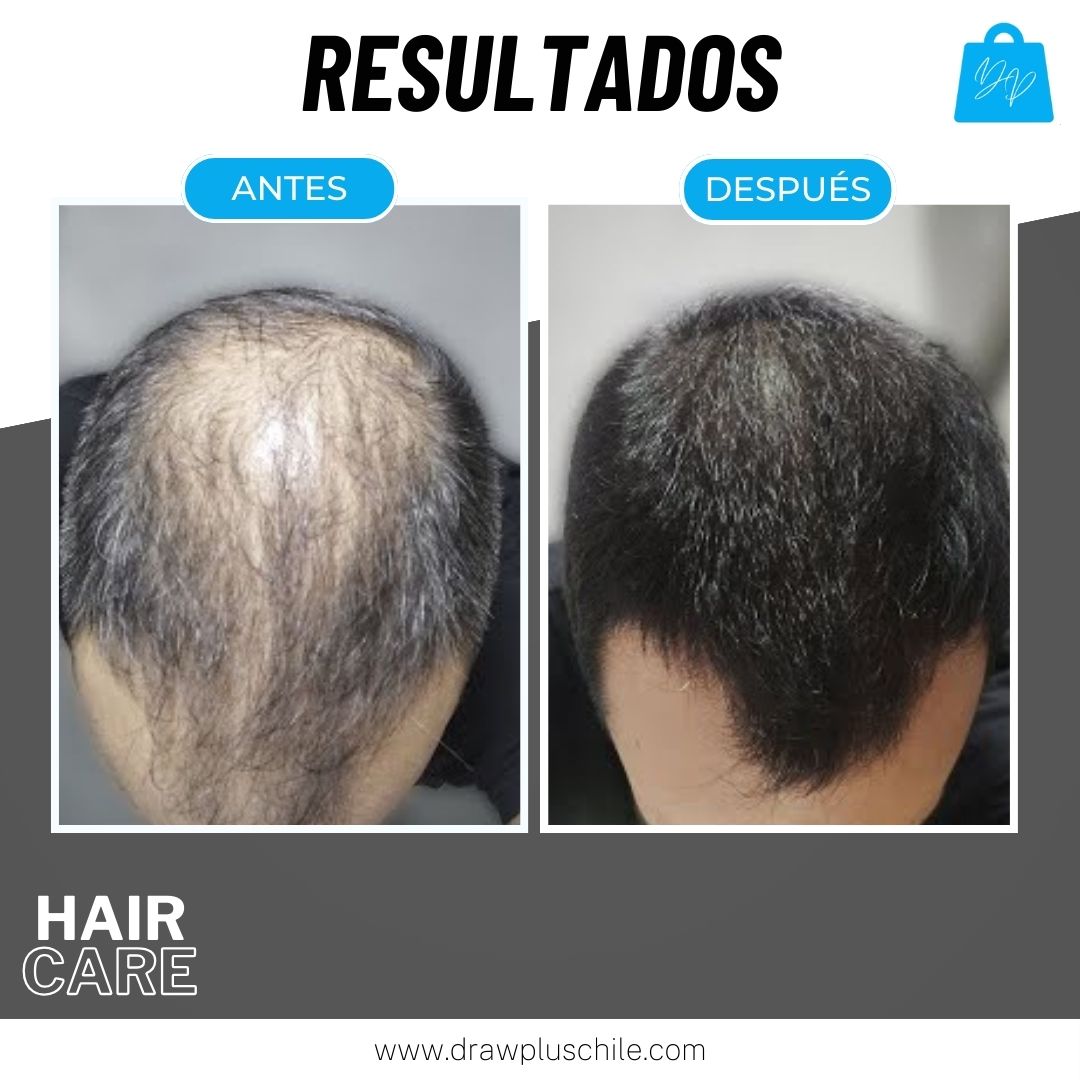 Shampoo anti caída en barra - HairCare™