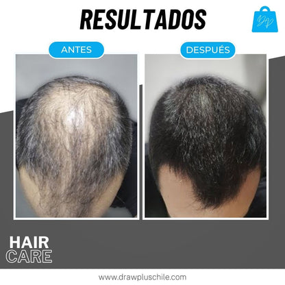 Shampoo anti caída en barra - HairCare™